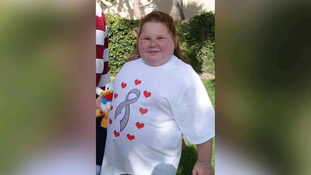 PHOTO: Alexis Shapiro has gained over 100 pounds after having a benign brain tumor removed.