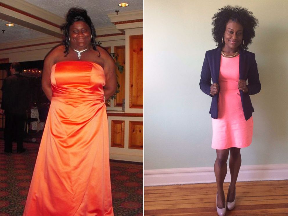 100 Lb Or More Weight Loss Success Stories
