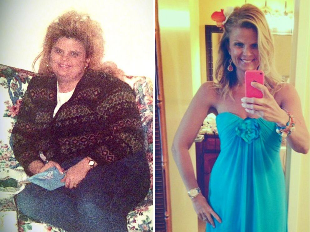 Extreme Weight-Loss Success Stories: How They Lost 100 Pounds or ...