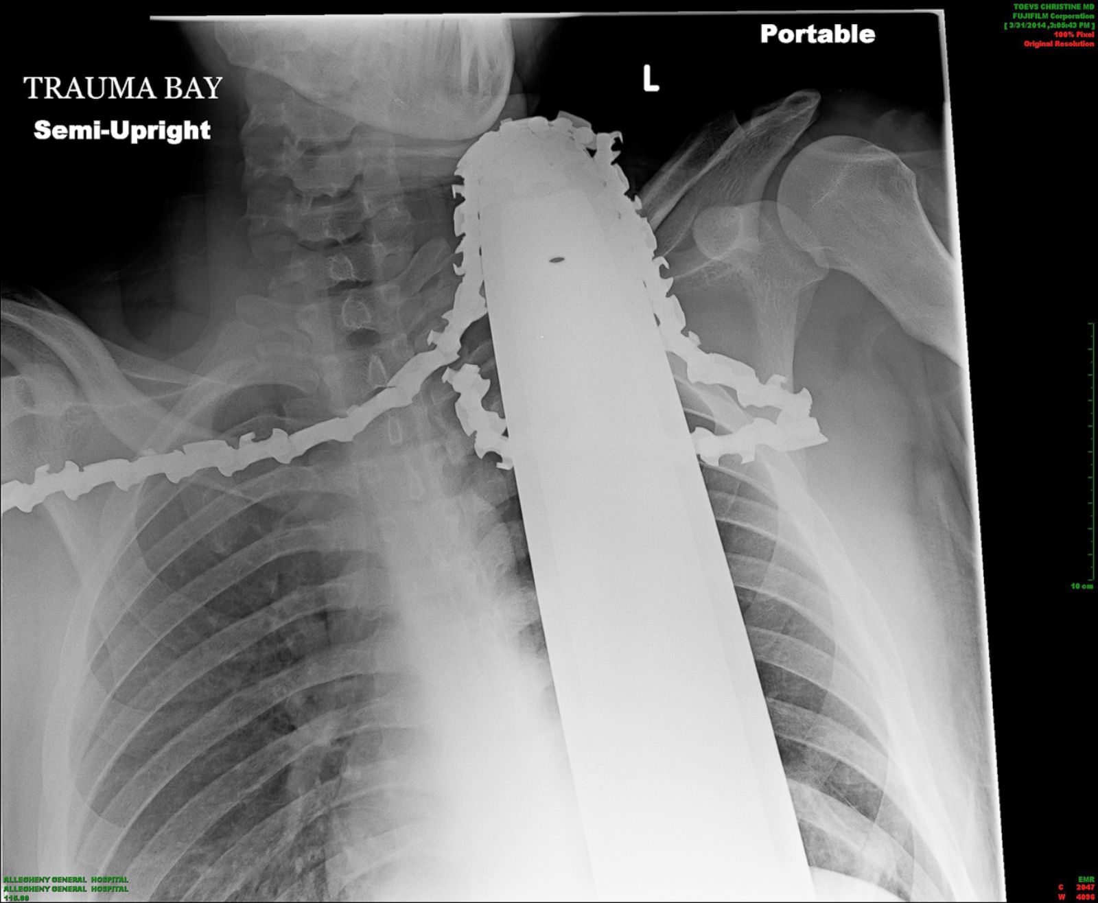 Deepest Throat X Ray Cumception