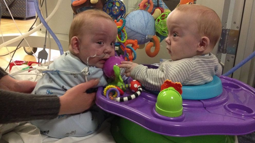 PHOTO: Owen and Emmitt Ezell formerly conjoined twins enjoy a play date. 