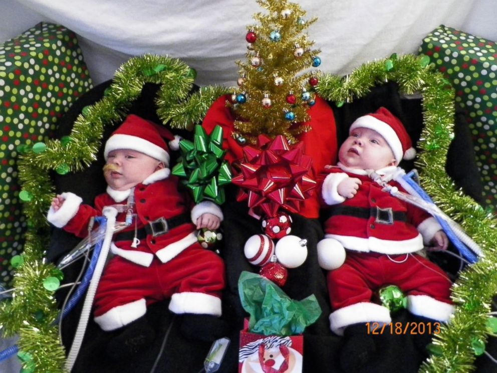 PHOTO: Formerly conjoined twins Owen and Emmitt Ezell get into the Christmas spirit.