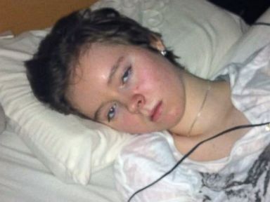 PHOTO: Jessica Taylor, 22, is confined to her bedroom with one of the most severe cases of myalgic encephalomyelitis or ME.