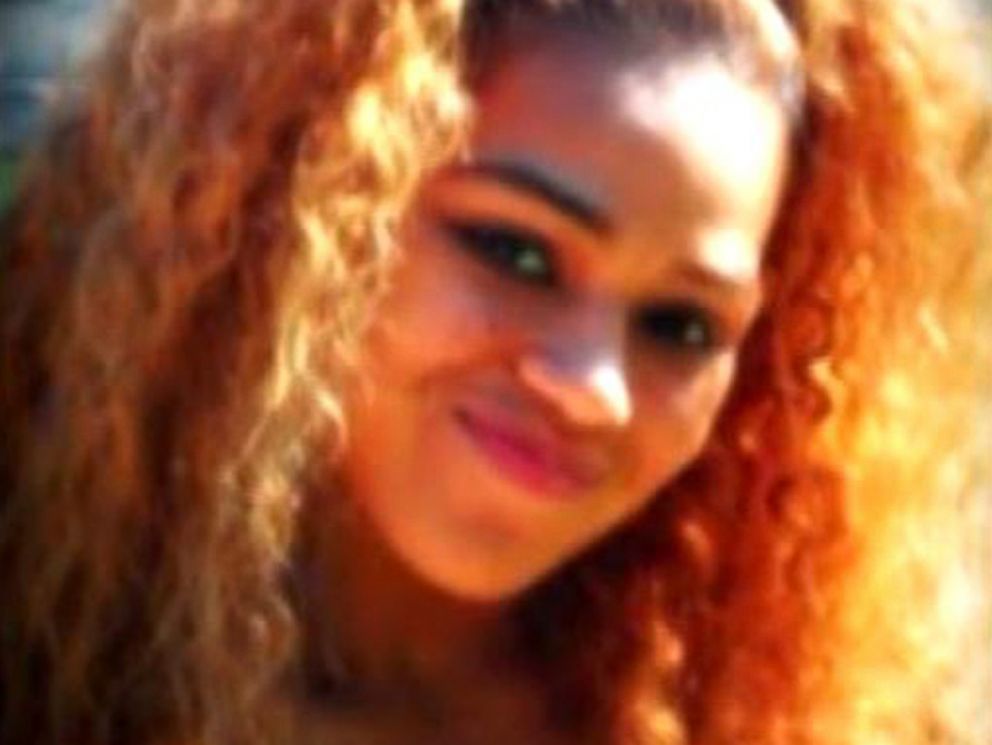 PHOTO: Yaasmeen Castanada is in intensive care after having a severe allergic reaction to a mediation that caused her body to blister from the inside out.