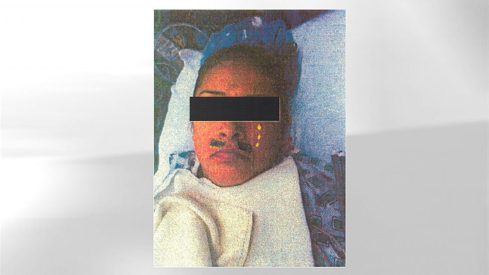 A Los Angeles woman is suing an area hospital and her anesthesiologist for allegedly putting a mustache and stickers on her face during surgery.