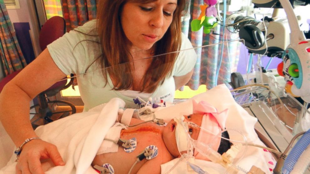 PHOTO: Riki Graves found out she had breast cancer when she was 8 weeks pregnant, but she soon learned that her unborn daughter would need to fight a health battle as well.