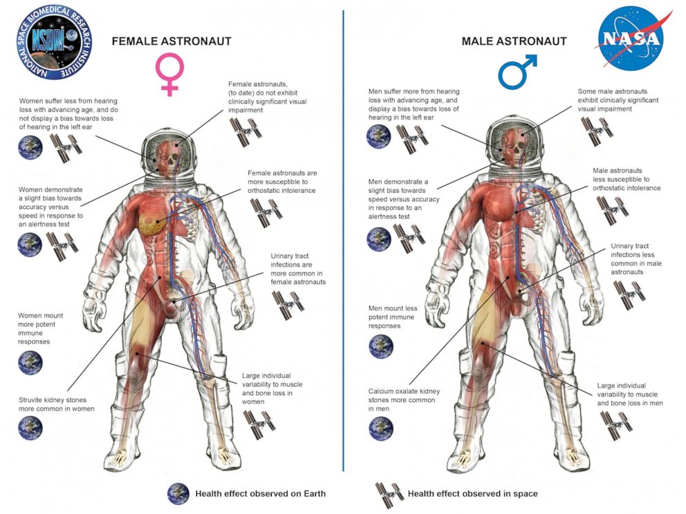 PHOTO:The ways women and men are different in zero gravity is noted in this info graphic provided by NASA.