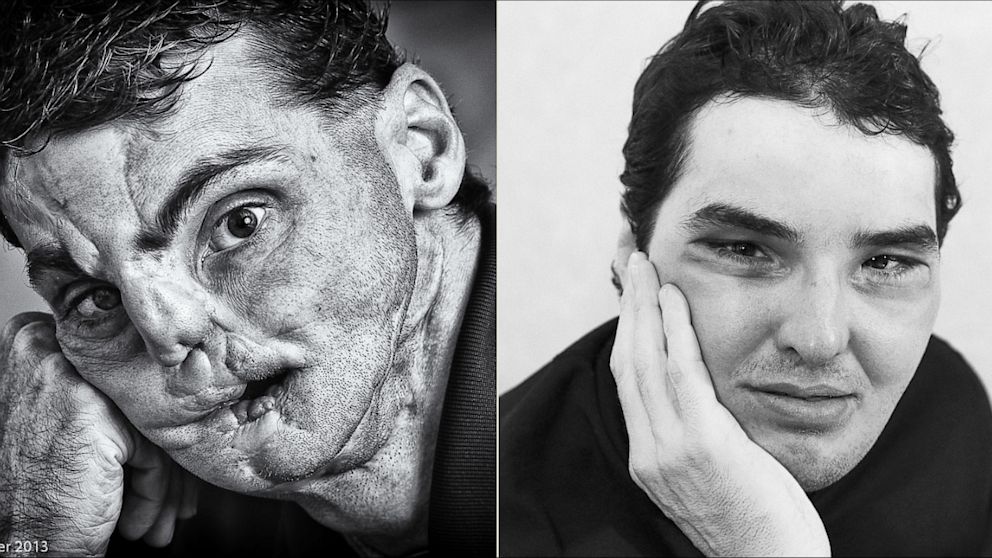 PHOTO: "The Two Faces of Richard"