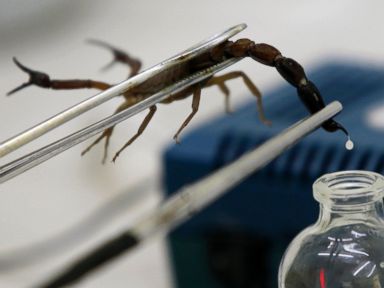 PHOTO: A technician extracts venom from a scorpion at Labiofam Laboratories in Cuba, August 5, 2011.