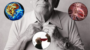 PHOTO Alzheimers disease is a difficult diagnosis to make.