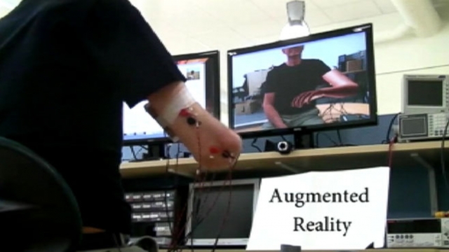 Phantom limb pain is relieved with help of computer-generated arm.