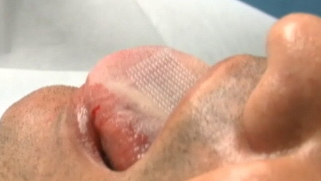 Video: Extreme Diet Plan: Tongue Patch