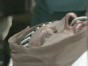 Hope for Burn Victims