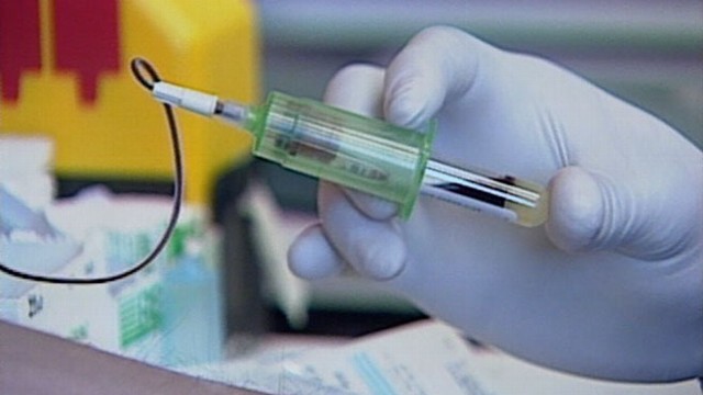VIDEO: Controversial test in the UK said to offer clues on person's life expectancy.