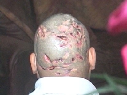 Video: Medical mystery baffles doctors.