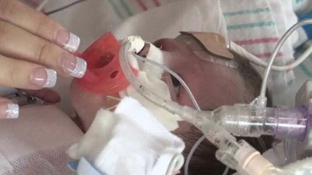 PHOTO: Audrina Cardenas was born with her heart outside her body.