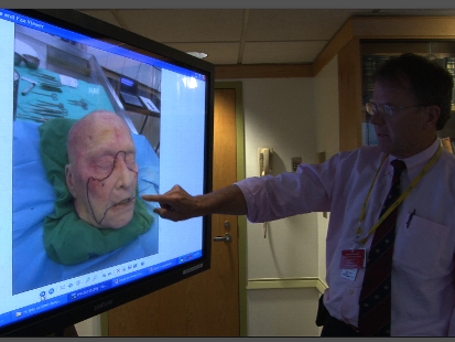 VIDEO: Exclusive Story of Groundbreaking Face Transplant