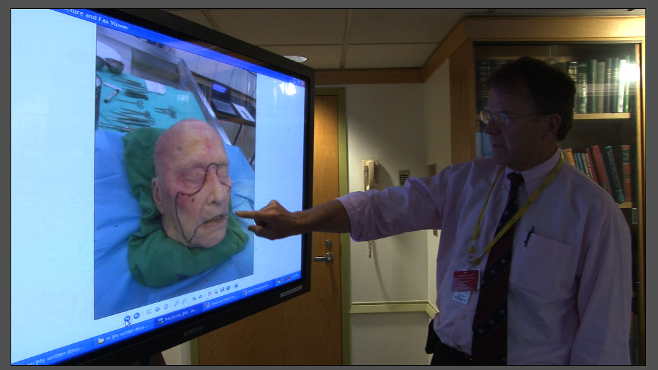VIDEO: Exclusive Story of Groundbreaking Face Transplant