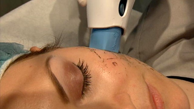 PHOTO: More young women are turning to preventive Botox injections and costly thermage treatments to prevent wrinkles before their happen.