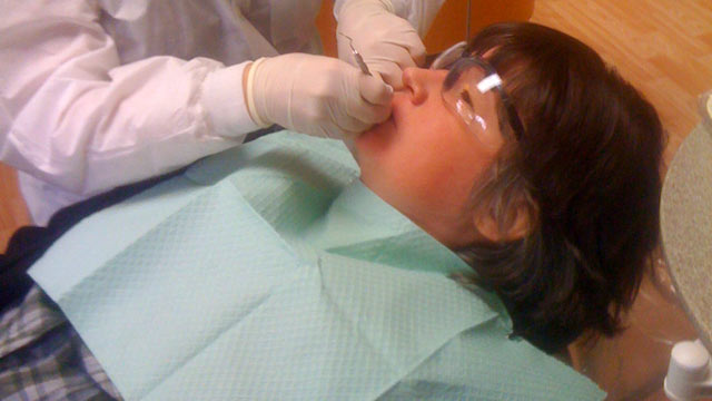 PHOTO: Tina Lumbley, 40, gets a filling at We Care dental clinic for people with disabilities.