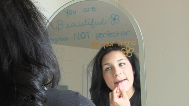 PHOTO: After wrestling with how she looks for years, Taylor, 20, was eventually diagnosed with EDNOS, or