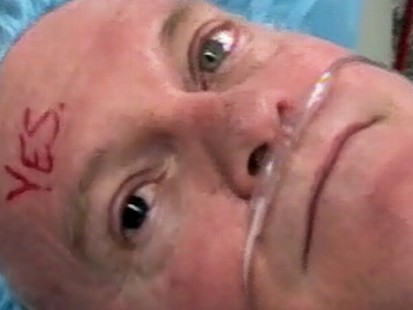 Video: Surgery corrects mans iris color.