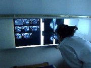 No Annual Mammograms for Those Under 50