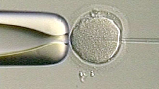 VIDEO: IVF Success Calculator