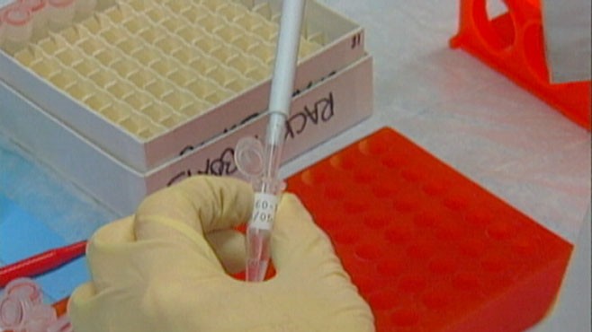 VIDEO: A Look at Alzheimer's Disease