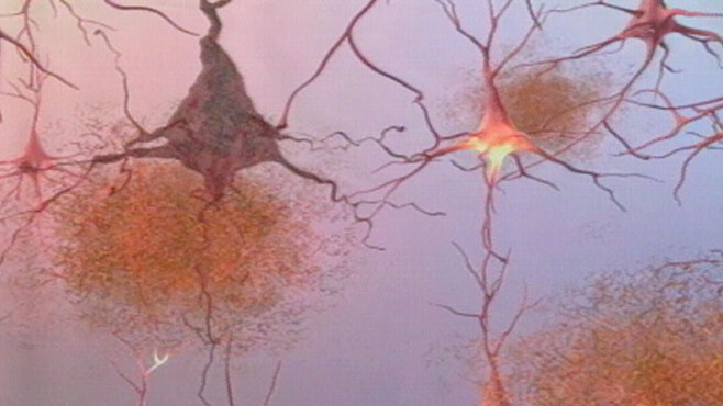 VIDEO: Tips to help you keep life balanced while caring for someone with Alzheimer's.