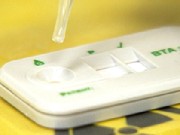 Are Cancer Screening Benefits Overrated?