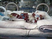 Infant Mortality Rates Rise