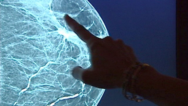 VIDEO: Find out how a new tool will allow doctors to detect cancer more accurately.