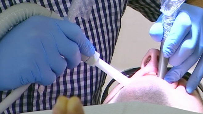 VIDEO: Exposing Dental Hygiene Myths