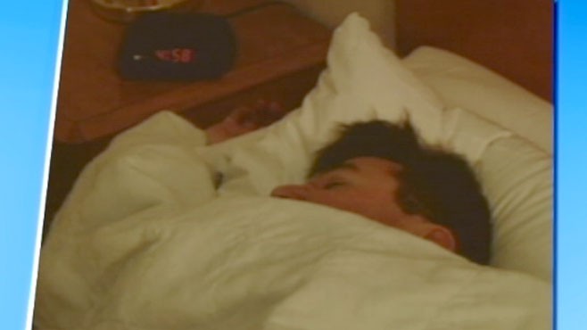 VIDEO: A new study says sleep really can affect our skin.