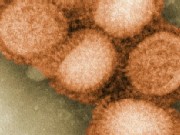 Are Cases of H1N1 Growing More Deadly?