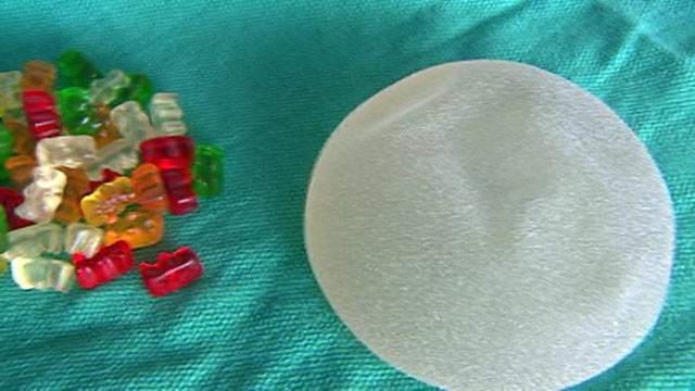 What do reviews say about gummy bear implants?