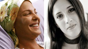 Photo: Woman Battles Melanoma In Real-Life Greys Anatomy Story