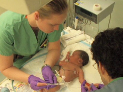 premature baby