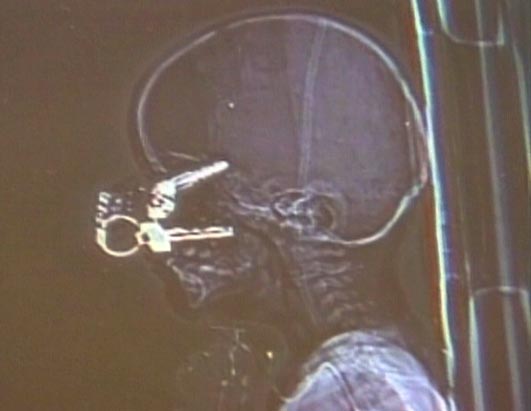 X-Ray Oddities