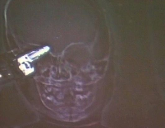 X-Ray Oddities
