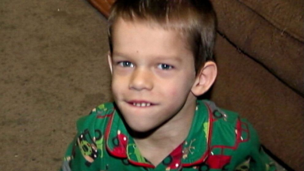 PHOTO: Zander Welton, 5, was born with cortical dysplasia, a genetic defect that disrupts cellular patterns in the brain and is often the cause of epilepsy.