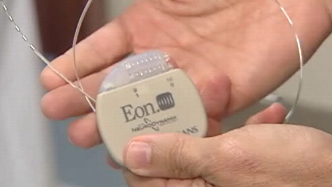 Video: New alternative for heart transplant surgery.