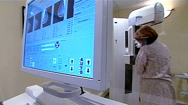 Should You Get a Mammogram?