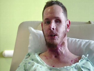 Rare Spinal Surgery Gives Marine Second Chance
