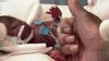 VIDEO:  New study finds premature births on the rise.