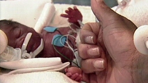 VIDEO: New study finds premature births on the rise.