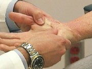Hard to Access Specialized Burn Care