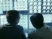 How Chemotherapy Affects Memory