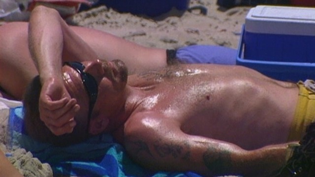 VIDEO: British researchers isolate molecule that triggers pain from sunburn.